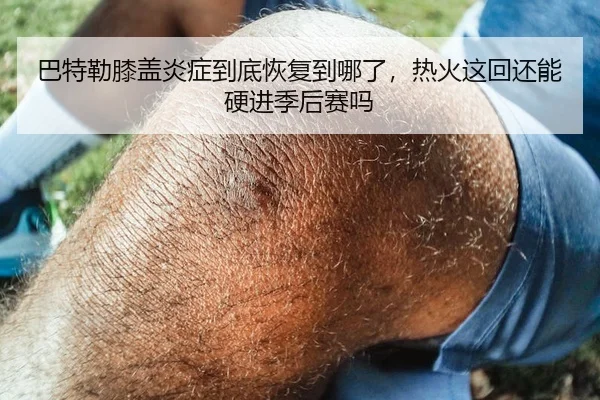 巴特勒膝盖炎症到底恢复到哪了，热火这回还能硬进季后赛吗